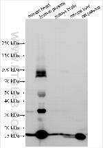 RAGE Antibody in Western Blot (WB)