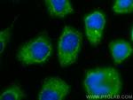 IL-1RA Antibody in Immunocytochemistry (ICC/IF)