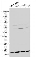 Transthyretin Antibody in Western Blot (WB)