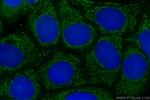 NRG1, isoform Beta1 Antibody in Immunocytochemistry (ICC/IF)