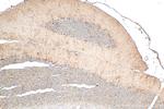 NRG1, isoform Beta1 Antibody in Immunohistochemistry (Paraffin) (IHC (P))