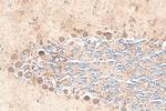 NRG1, isoform Beta1 Antibody in Immunohistochemistry (Paraffin) (IHC (P))