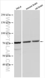 NRG1, isoform Beta1 Antibody in Western Blot (WB)