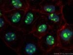 TBL3 Antibody in Immunocytochemistry (ICC/IF)