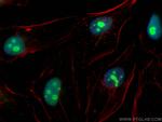 TBL3 Antibody in Immunocytochemistry (ICC/IF)