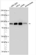 TBL3 Antibody in Western Blot (WB)