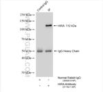 HIRA Antibody in Immunoprecipitation (IP)