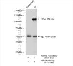 HIRA Antibody in Immunoprecipitation (IP)