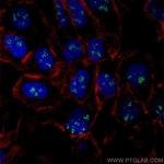 CD3EAP Antibody in Immunocytochemistry (ICC/IF)