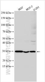 TRMT61A Antibody in Western Blot (WB)