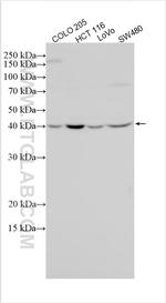 METTL8 Antibody in Western Blot (WB)