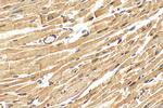 RBM20 Antibody in Immunohistochemistry (Paraffin) (IHC (P))