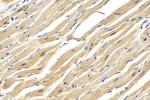 RBM20 Antibody in Immunohistochemistry (Paraffin) (IHC (P))