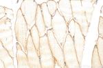 LAMA2 Antibody in Immunohistochemistry (Paraffin) (IHC (P))