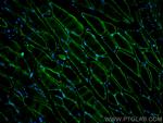 LAMA2 Antibody in Immunohistochemistry (PFA fixed) (IHC (PFA))