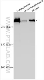 LAMA2 Antibody in Western Blot (WB)