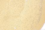 Cullin 5 Antibody in Immunohistochemistry (Paraffin) (IHC (P))