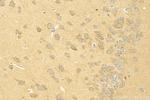 Cullin 5 Antibody in Immunohistochemistry (Paraffin) (IHC (P))