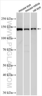 PCARE Antibody in Western Blot (WB)