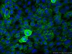 COL17A1 Antibody in Immunocytochemistry (ICC/IF)