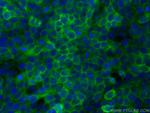 COL17A1 Antibody in Immunocytochemistry (ICC/IF)