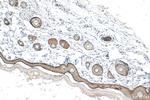 COL17A1 Antibody in Immunohistochemistry (Paraffin) (IHC (P))