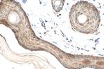 COL17A1 Antibody in Immunohistochemistry (Paraffin) (IHC (P))
