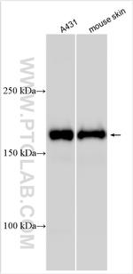 COL17A1 Antibody in Western Blot (WB)