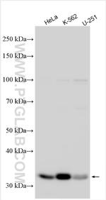 ABCA9 Antibody in Western Blot (WB)