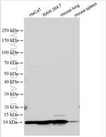 RAB44 Antibody in Western Blot (WB)