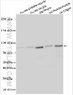 NCKAP5 Antibody in Western Blot (WB)