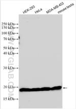 RPS11 Antibody in Western Blot (WB)