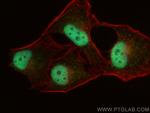 DDX42 Antibody in Immunocytochemistry (ICC/IF)
