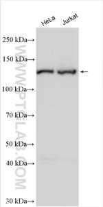 DDX42 Antibody in Western Blot (WB)