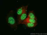 TSEN34 Antibody in Immunocytochemistry (ICC/IF)