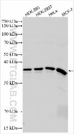 TSEN34 Antibody in Western Blot (WB)