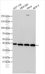 TSEN34 Antibody in Western Blot (WB)