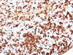 HLA-DR (MHC II) Recombinant Rabbit Monoclonal Antibody (HLA-DRA/6839R)