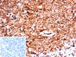 HLA-DR (MHC II) Antibody in Immunohistochemistry (Paraffin) (IHC (P))