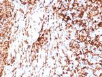 HLA-DR (MHC II) Recombinant Rabbit Monoclonal Antibody (HLA-DRA/6840R)