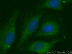 CUL9 Antibody in Immunocytochemistry (ICC/IF)