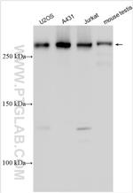 CUL9 Antibody in Western Blot (WB)