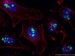 P14-ARF Antibody in Immunocytochemistry (ICC/IF)