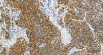P14-ARF Antibody in Immunohistochemistry (Paraffin) (IHC (P))
