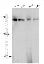 P14-ARF Antibody in Western Blot (WB)