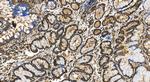 YARS Antibody in Immunohistochemistry (Paraffin) (IHC (P))