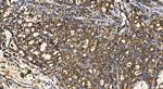 YARS Antibody in Immunohistochemistry (Paraffin) (IHC (P))