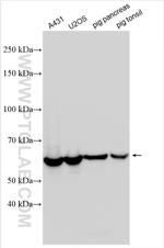 YARS Antibody in Western Blot (WB)