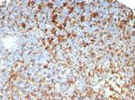 HLA-DRB (MHC II) Recombinant Rabbit Monoclonal Antibody (HLA-DRB/7795R)