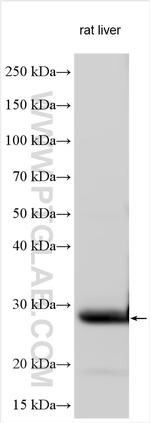 RTTN Antibody in Western Blot (WB)
